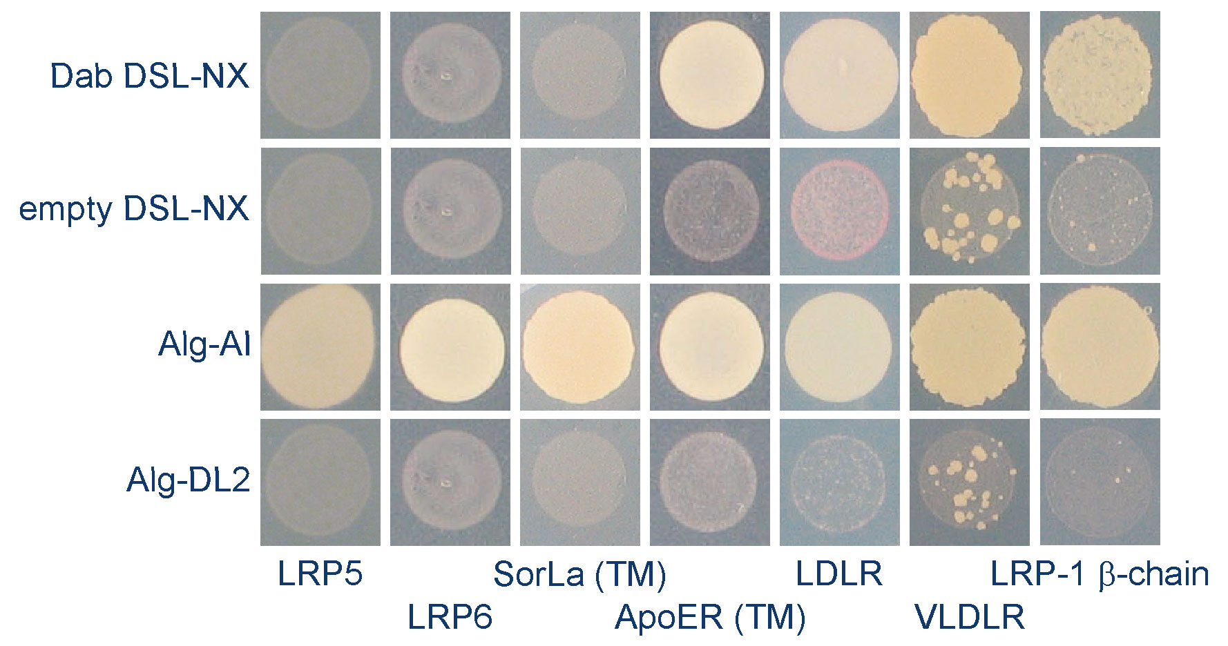 method fordetermination of cholesterol in low density lipoprotein
