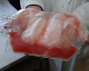 Stammzelltransplantat