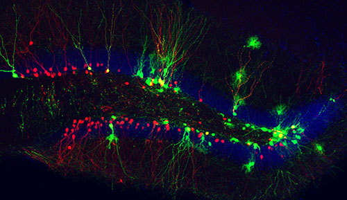 neugeborene Körnerzellen im erwachsenen Hippocampus