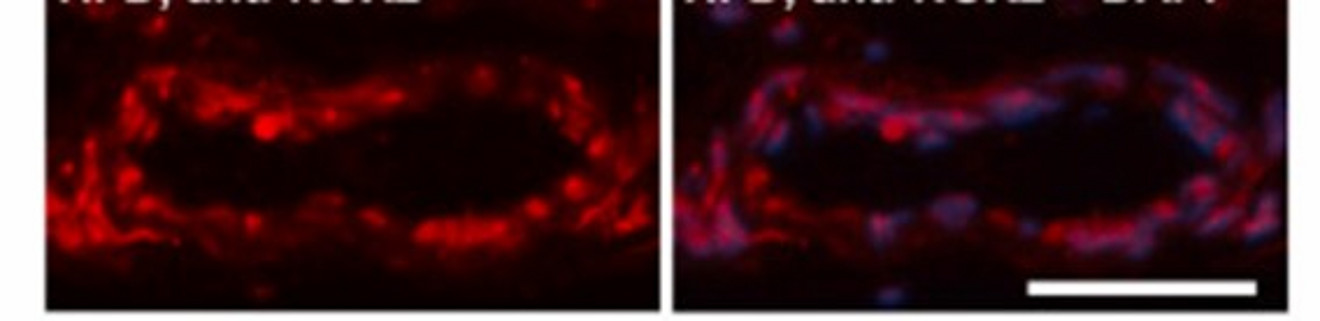 Immunhistochemische Färbung mittels Anti-NOX2-Antikörpern einer murinen Arteria ophthalmica