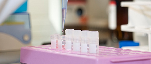 Translationale- und Grundlagenforschung