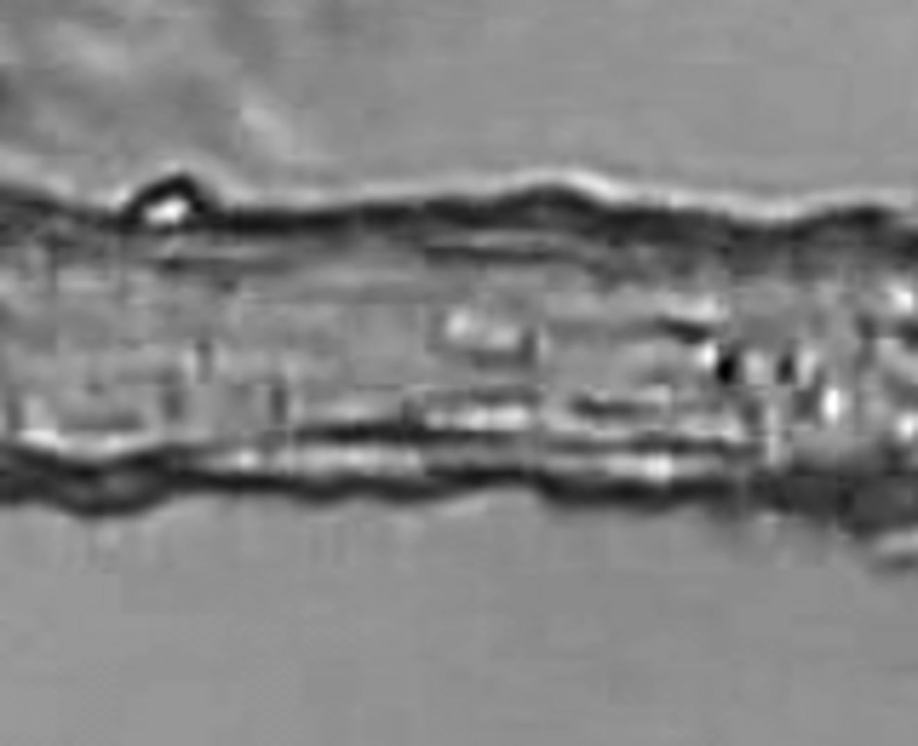 Videomikroskopische Aufnahme einer isolierten zerebralen Arteriole der Maus