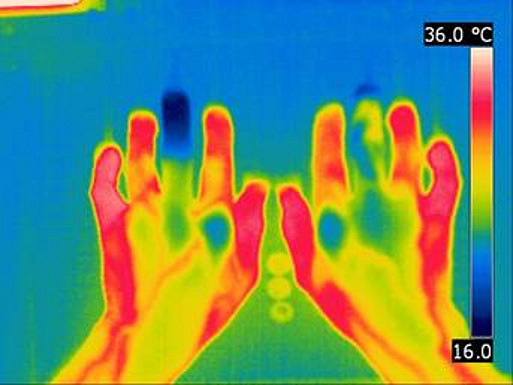Thermographie
