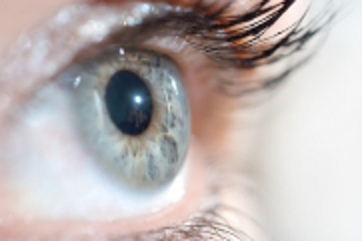 auge2