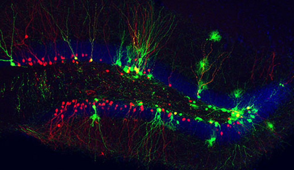 neugeborene Körnerzellen im erwachsenen Hippocampus