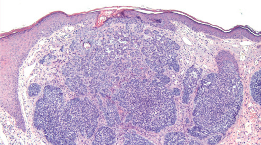 histologische Aufnahme