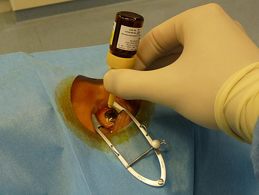 Crosslinking