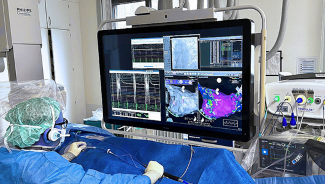 Katheterablation