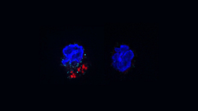 ACC-mediated FAS is required for IL-17A expression in γδT17 cells under psoriatic conditions.