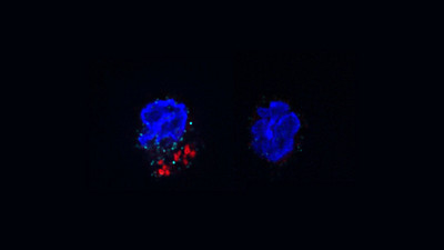 ACC-mediated FAS is required for IL-17A expression in γδT17 cells under psoriatic conditions.