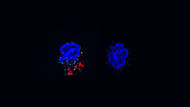 ACC-mediated FAS is required for IL-17A expression in γδT17 cells under psoriatic conditions.