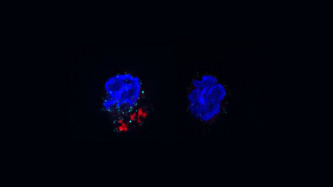 ACC-mediated FAS is required for IL-17A expression in γδT17 cells under psoriatic conditions.