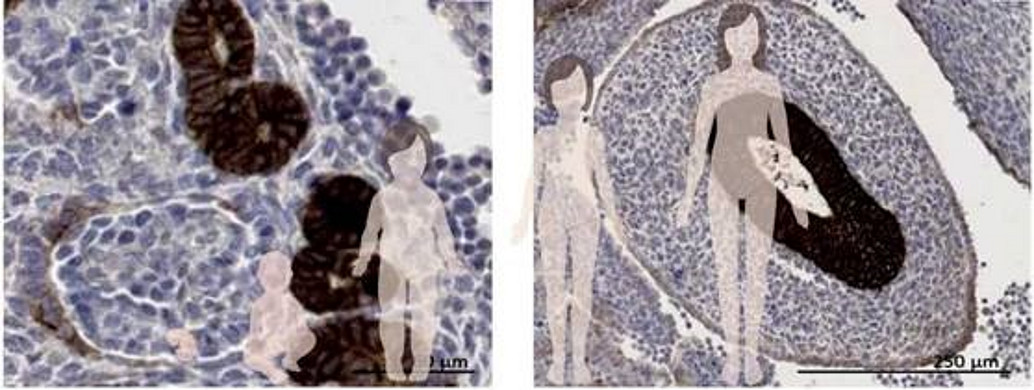 Modified from Seidmann et al, 2025, PMID: 40149257