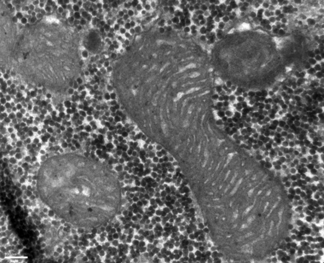 Elektronenmikroskopische Aufnahme von Mitochondrien Elektronenmikroskopische Aufnahme von Mitochondrien