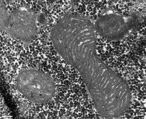 Elektronenmikroskopische Aufnahme von Mitochondrien