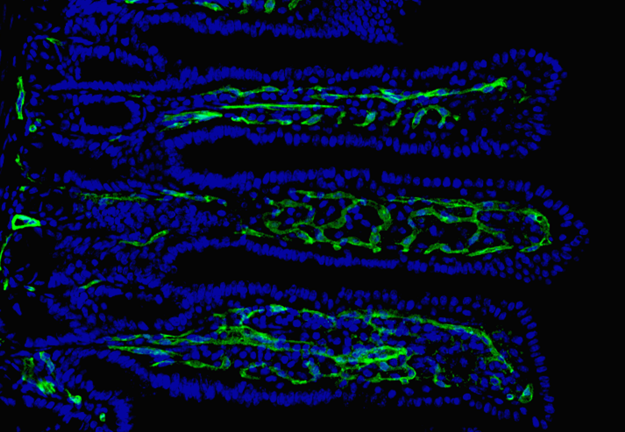Das Bild zeigt eine mikroskopische Aufnahme von Dünndarmzotten mit Kapillargefäßen (grün) und Zellkernen (blau). 