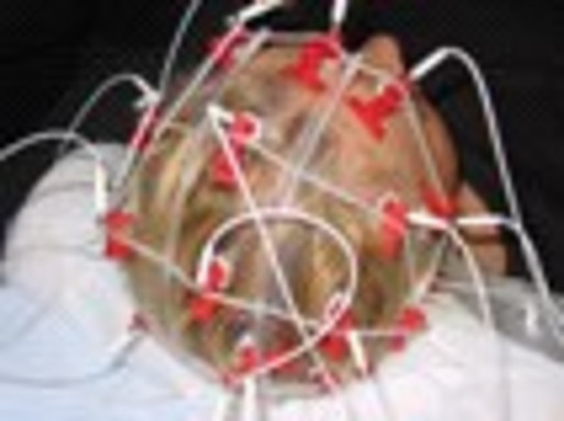 EEG