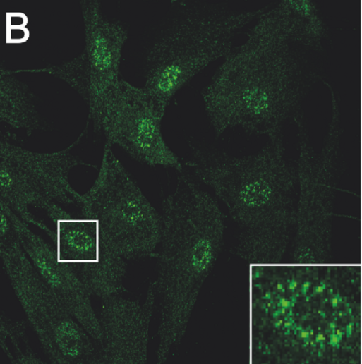 RAB3GAP RNAi