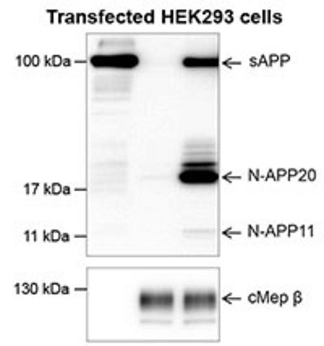 Überexpression von Meprin β