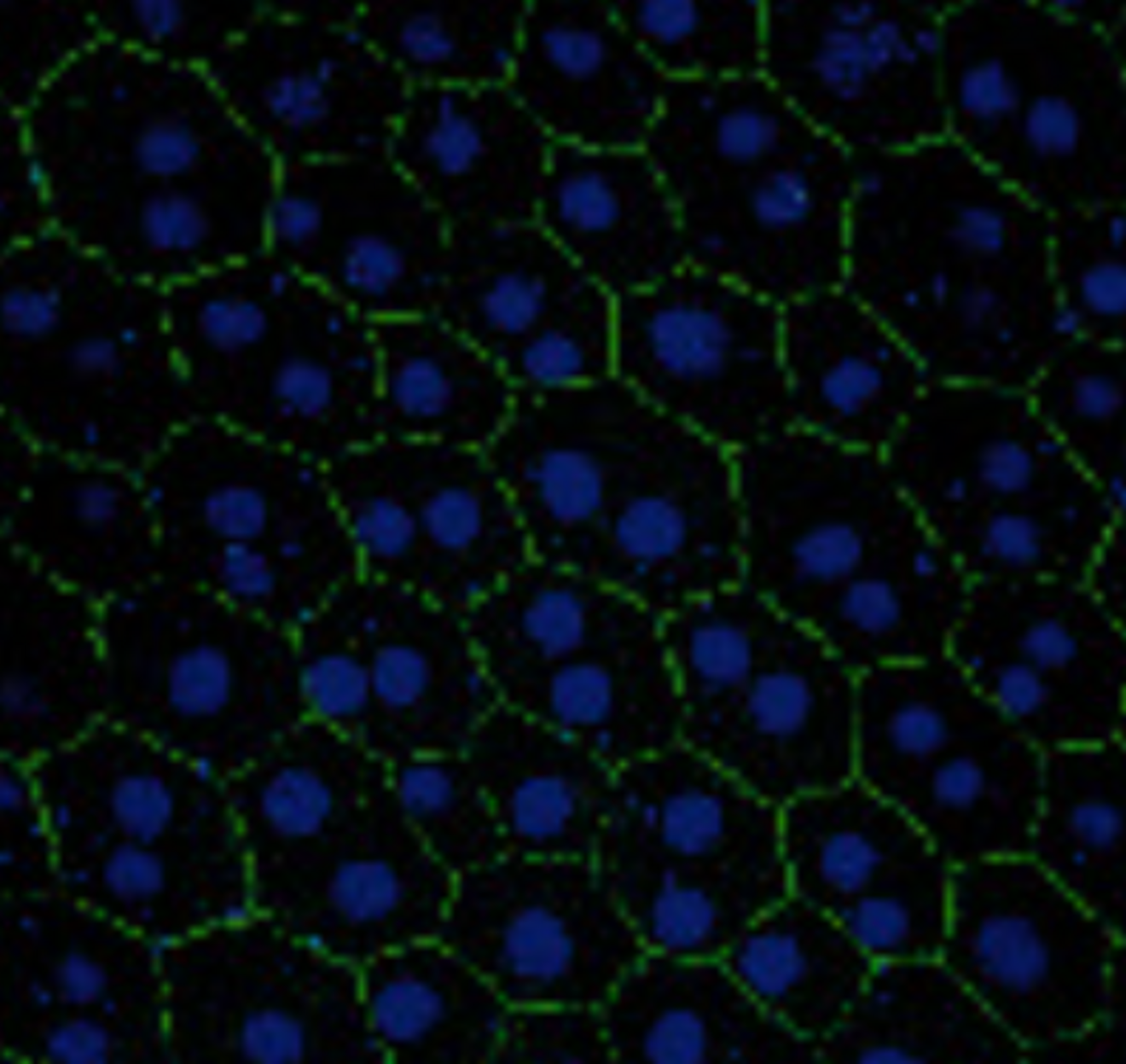 Konfokalmikroskopische Aufnahme eines RPE-Flatmount-Präparates nach ZO-1-Immunfluoreszenzfärbung.