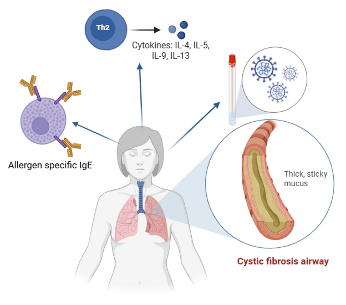 Allergen-specific IgE sensitization, respiratory viral infections and cytokine in cystic fibrosis and primary ciliary dyskinesia