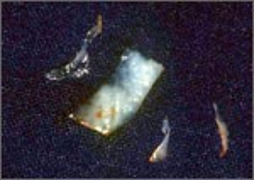 Freies Schleimhauttransplantat