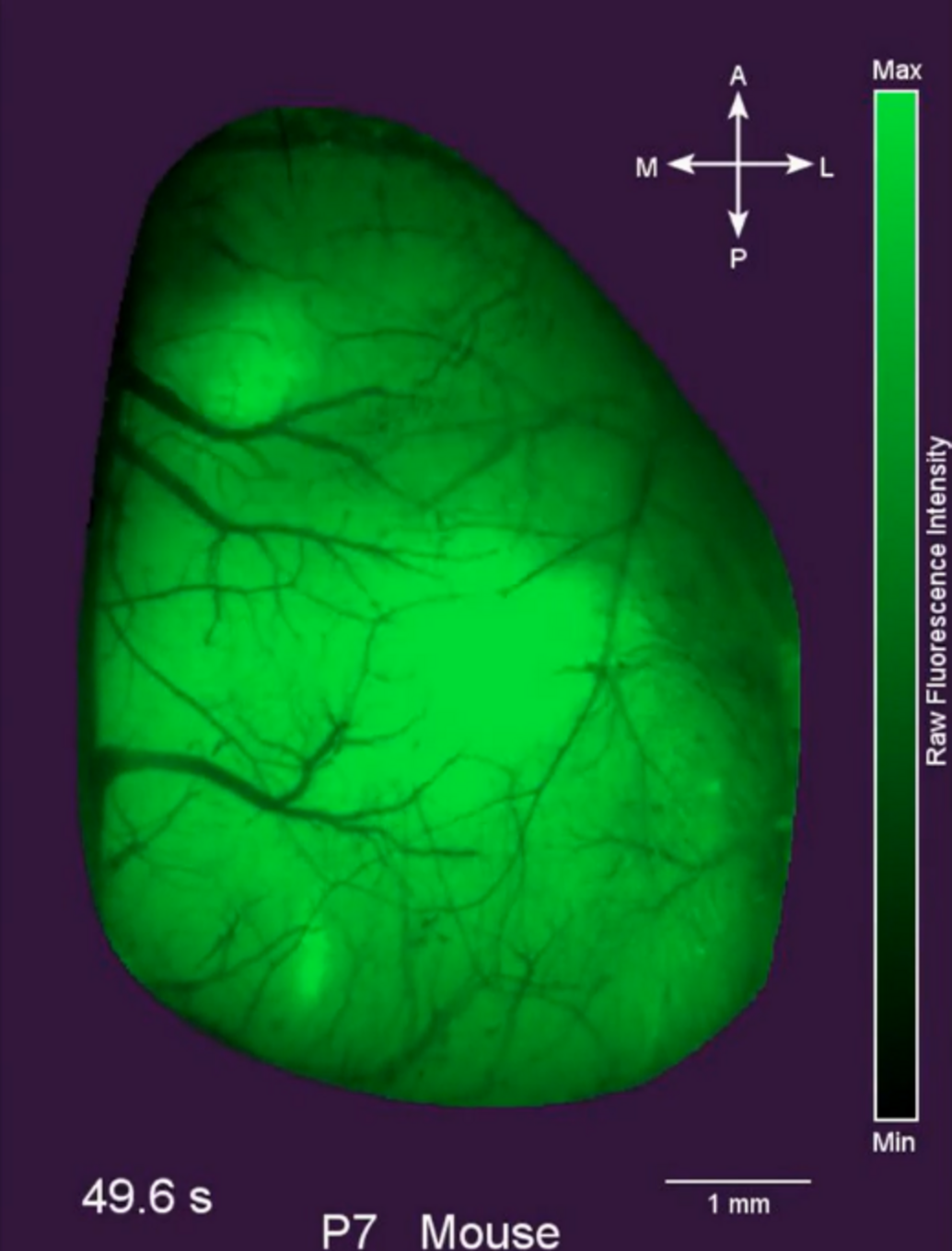 Widefield calcium imaging of cortical activity