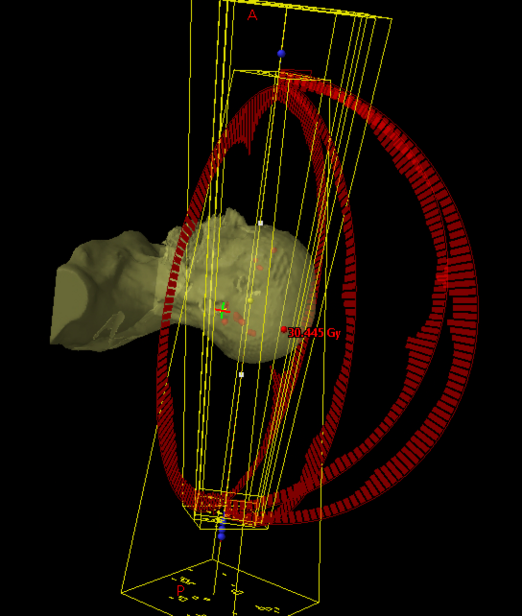 HyperArc#1