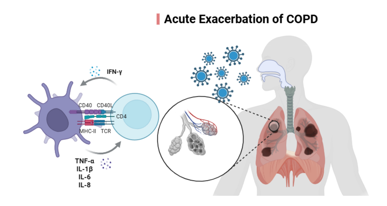 Infectious triggers and biomarkers as predictors of acute exacerbations in COPD patients.