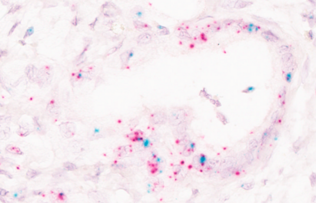 Immunpatho4