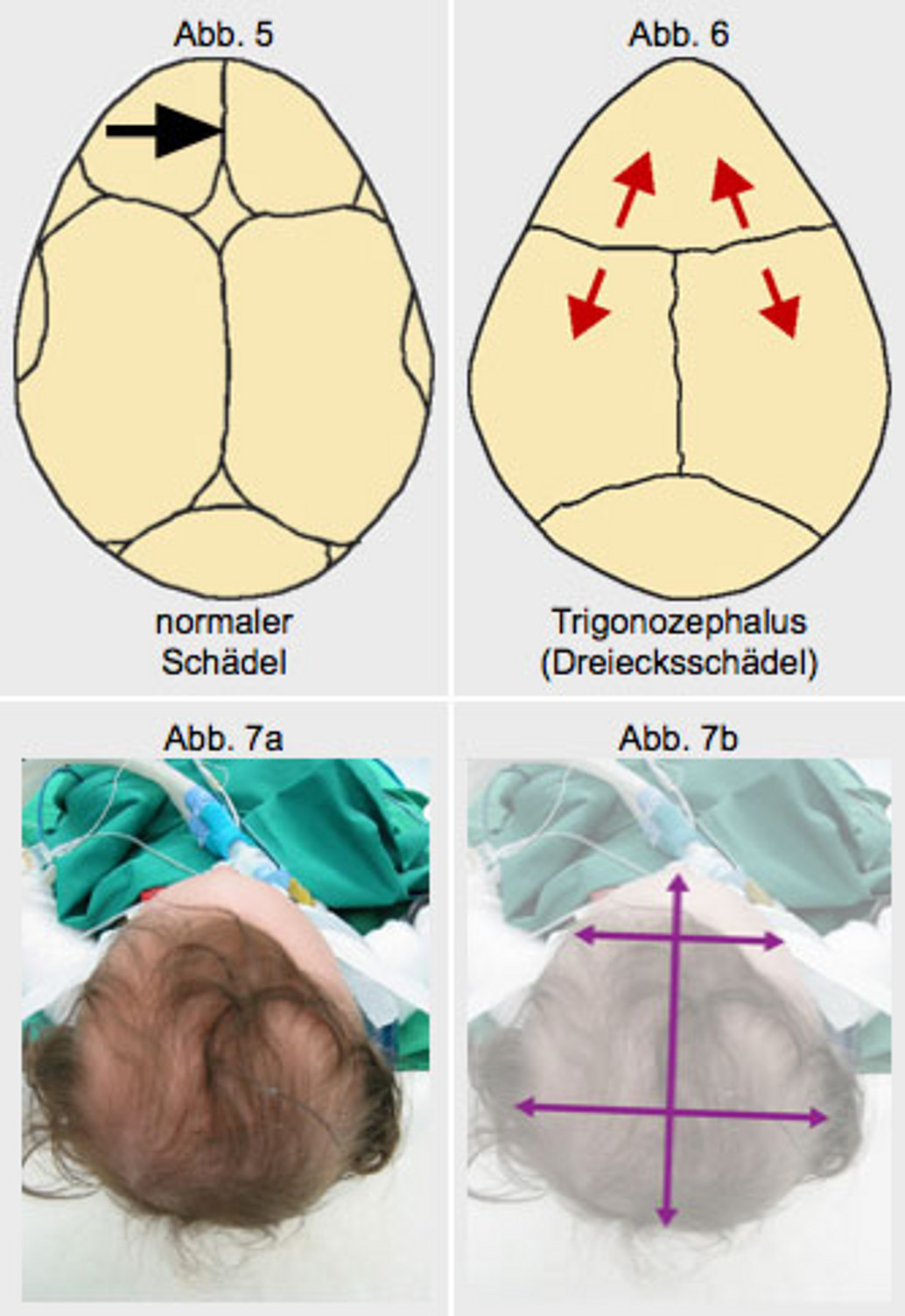 01dolichozephalus.jpg