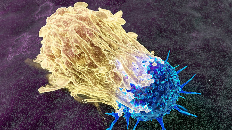 Illustration einer Immunzelle, die Krebszelle angreiift