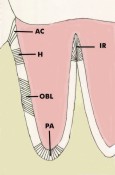 PDL_fibers2_sm.jpg (5717 bytes)