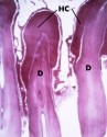 histo123a2_sm.jpg
  (5543 bytes)