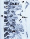 histo50A2a_sm.jpg




  (6048 bytes)