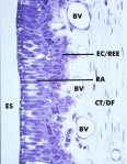 histo51a_sm.jpg




  (8232 bytes)