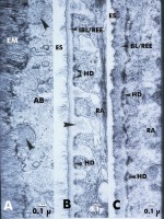 histo53A_sm.jpg




  (15453 bytes)